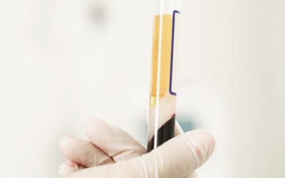 Do you know the difference between regenerative products and regenerative therapies, such as PRP?